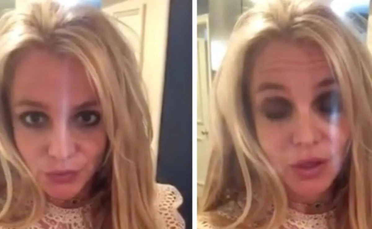 Britney Spears fue hospitalizada tras su arresto por conducir bajo los efectos del alcohol