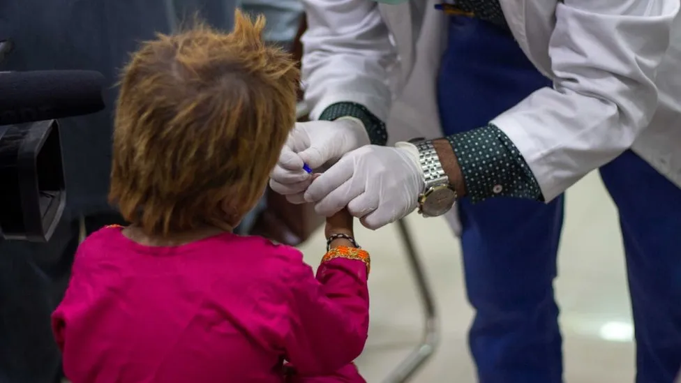 Investigan brote de VIH tras contagio de 78 niños en hospital de Pakistán