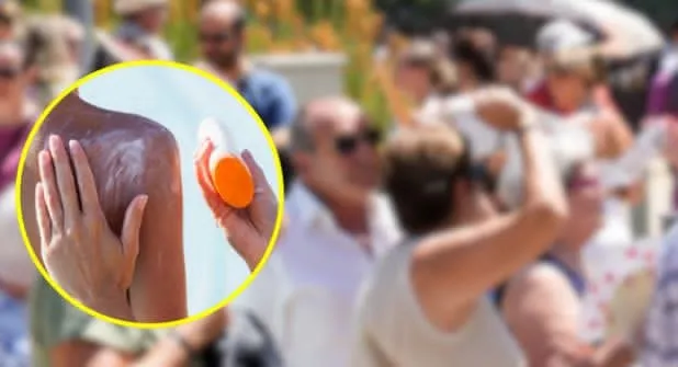 Calor extremo en Nuevo León aumenta la exposición solar; dermatólogo pide usar bloqueador todos los días