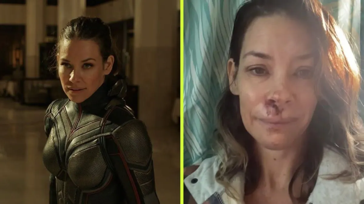 Evangeline Lilly revela que sufre daño cerebral tras una caída durante vacaciones